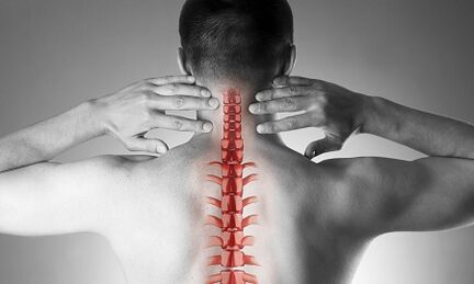 How is the osteochondrosis of the cervical spine manifested