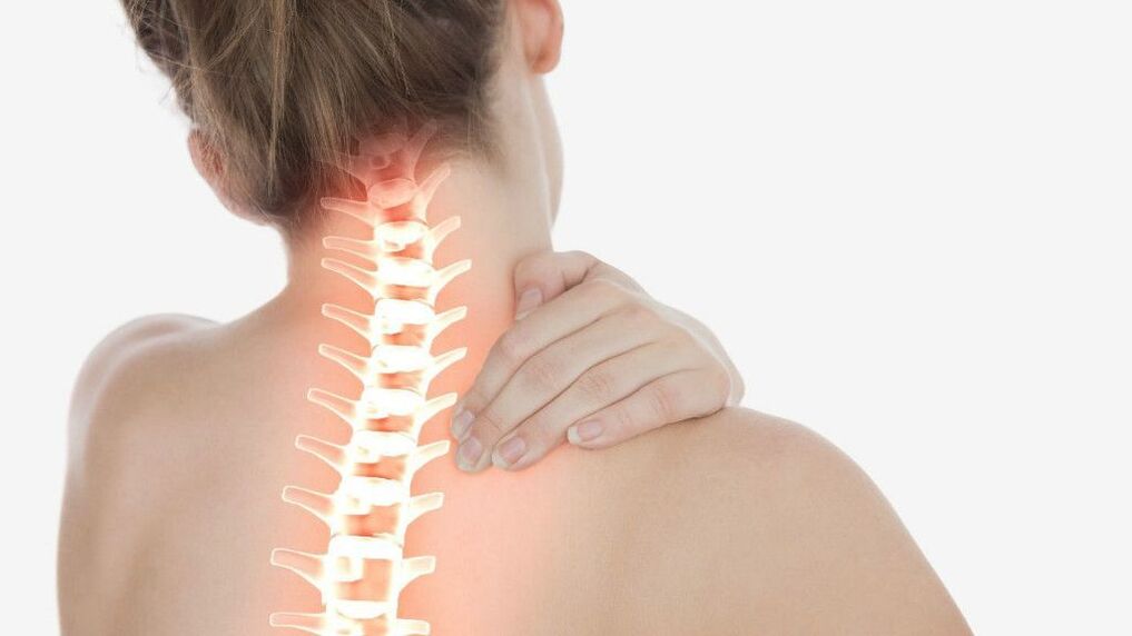 Neck pain due to osteochondrosis of the cervical vertebrae
